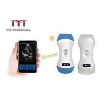 New Probe Cheap Sonoscape Portable Ultrasound Scanner for Sale